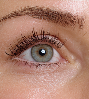 After Lashes Example 1 with Hawrych MD Lash