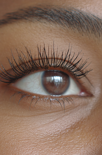 After Lashes Example 3 with Hawrych MD Lash