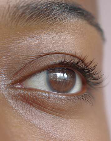 Before Lashes Example 3